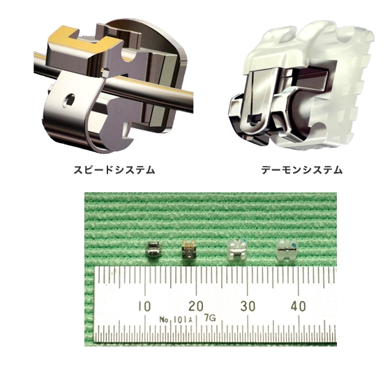 スピードシステム・デーモンシステム